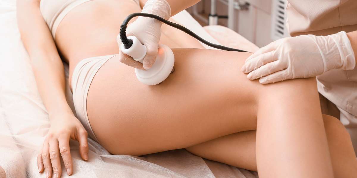 Celullitis-behandeling
